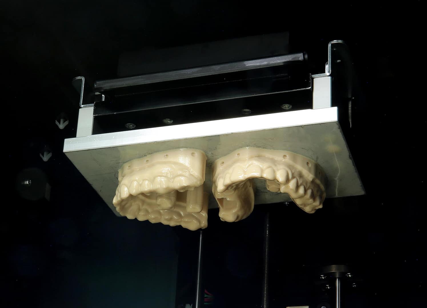 3-D gedrucktes Gebiss aus einem Resin-Drucker